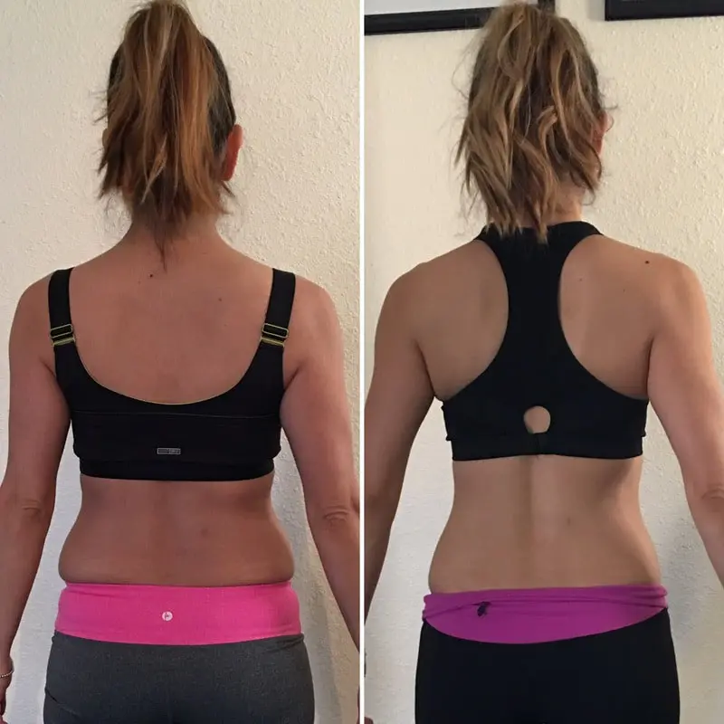 KM Wellness Center client success story in El Paso (42)